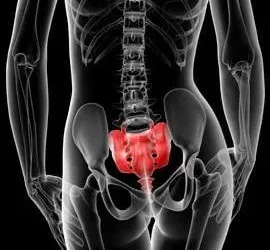 Why Is a Sacroiliac Joint Dysfunction so Difficult to Self-Diagnose?