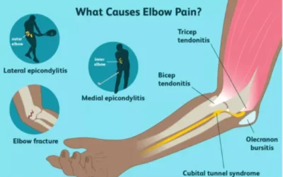 Elbow Pain: Is There an Easy Fix?